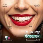 Doha SDC dental social media, healthcare content Qatar, clinic Instagram design